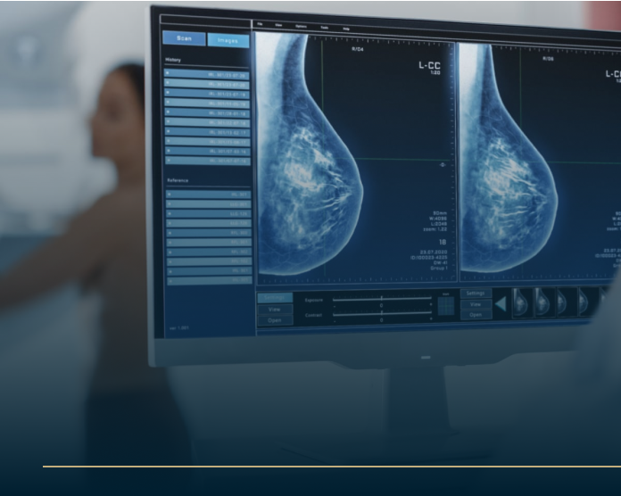 A computer monitor displaying two breast mammogram images with diagnostic data. The background shows a blurred figure, possibly a healthcare professional or patient. The overall tone is clinical and focused on medical imaging.