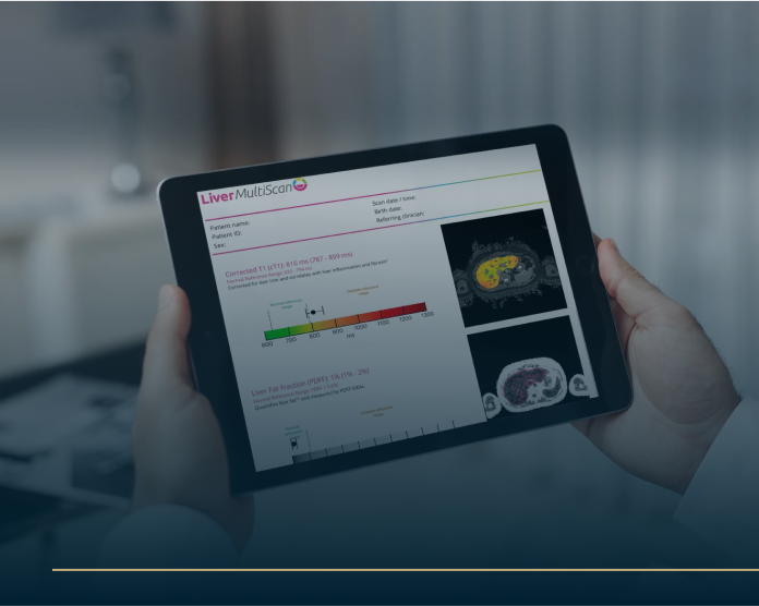 A person holds a tablet displaying medical imaging scans and data labeled Liver MultiScan. The screen shows colorful graphs and images of liver scans, with various metrics and details visible.