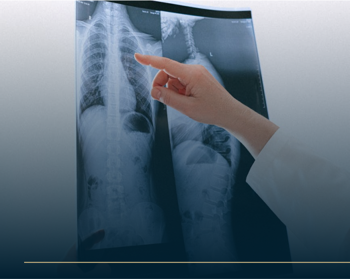 A hand pointing at a chest X-ray image displayed against a light source. The X-ray shows the bones and structure of the ribcage and spine. The person examining the X-ray appears to be wearing a white coat.